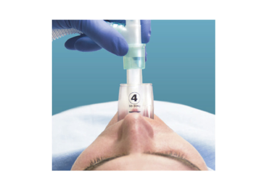 喉罩（英特賽克）